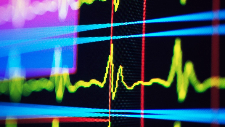 Inflation Reduction Act’s Drug Price Negotiation Provisions – What Now?